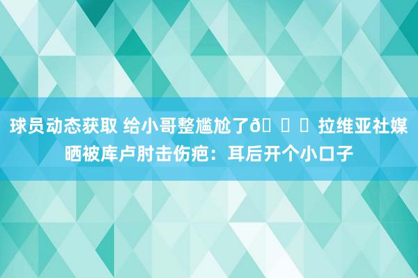 球员动态获取 给小哥整尴尬了😅拉维亚社媒晒被库卢肘击伤疤：耳后开个小口子